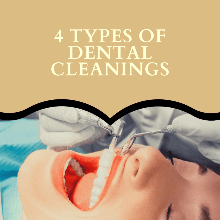 4 types of dental cleanings-min