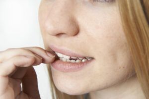 bad habits that harm your teeth